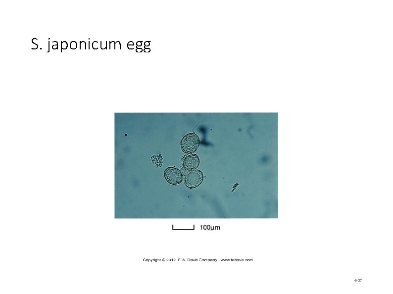 S. japonicum egg 4 -37 