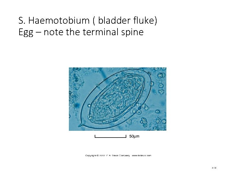 S. Haemotobium ( bladder fluke) Egg – note the terminal spine 4 -38 