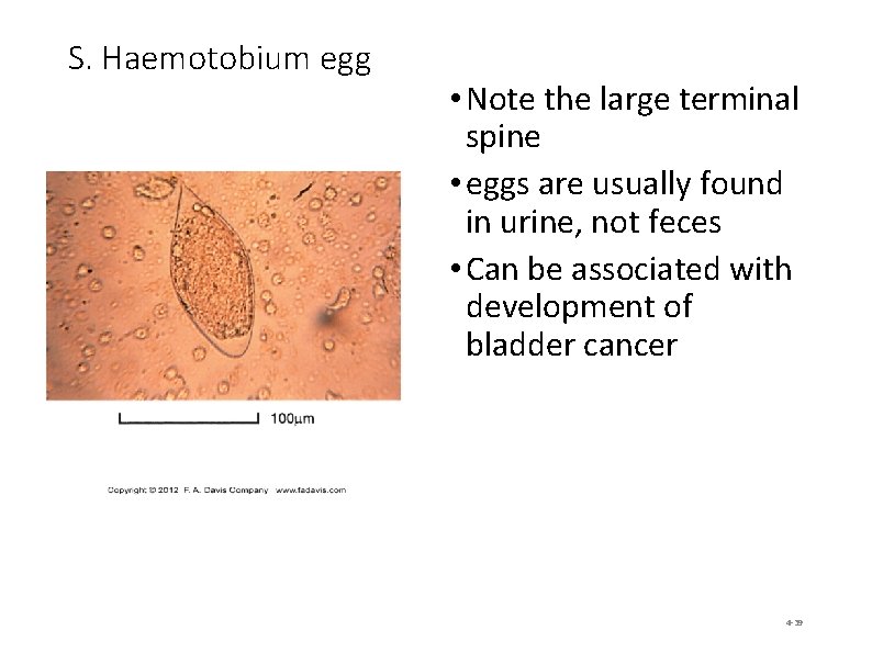 S. Haemotobium egg • Note the large terminal spine • eggs are usually found