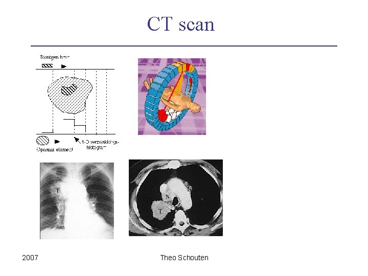 CT scan 2007 Theo Schouten 