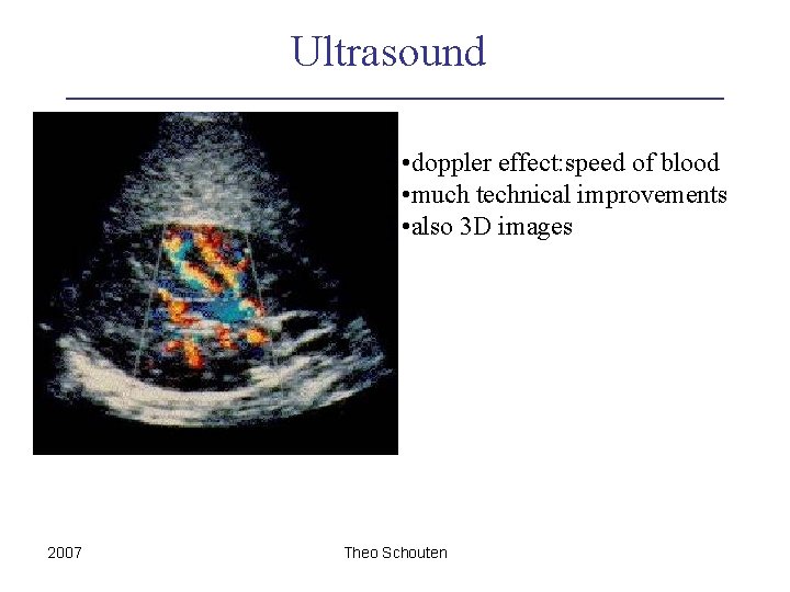 Ultrasound • doppler effect: speed of blood • much technical improvements • also 3