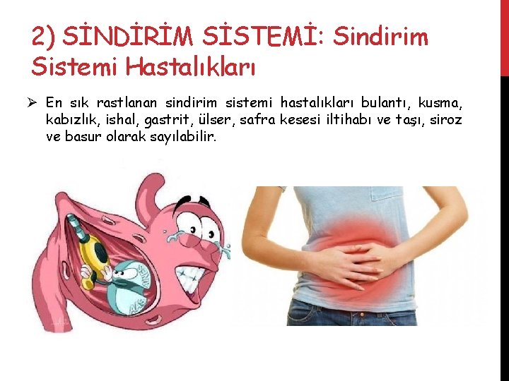 2) SİNDİRİM SİSTEMİ: Sindirim Sistemi Hastalıkları Ø En sık rastlanan sindirim sistemi hastalıkları bulantı,