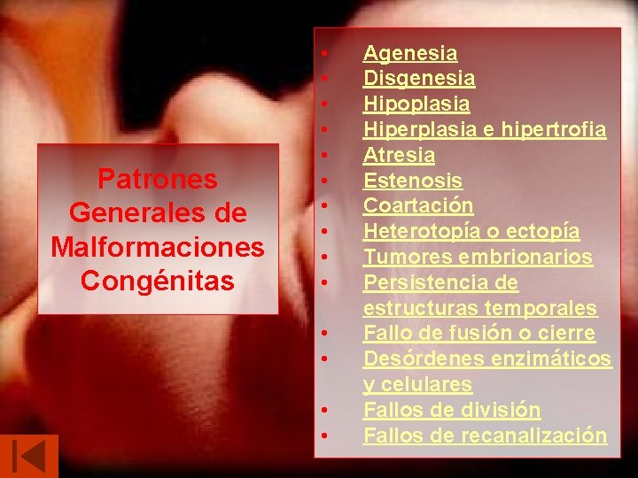 Patrones Generales de Malformaciones Congénitas • • • • Agenesia Disgenesia Hipoplasia Hiperplasia e