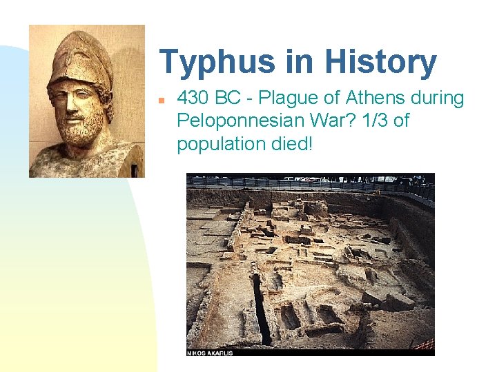 Typhus in History n 430 BC - Plague of Athens during Peloponnesian War? 1/3