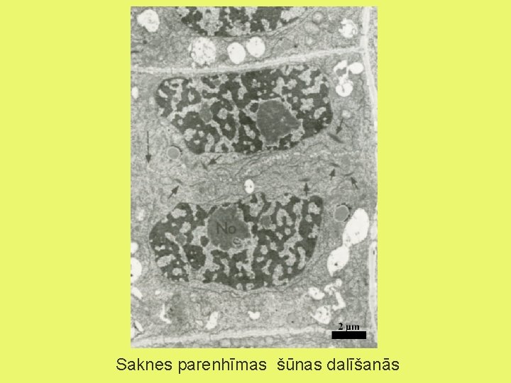 Saknes parenhīmas šūnas dalīšanās 