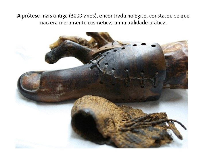 A prótese mais antiga (3000 anos), encontrada no Egito, constatou-se que não era meramente