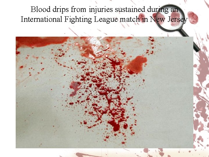 Blood drips from injuries sustained during an International Fighting League match in New Jersey Blood drips from injuries sustained during an International Fighting League match in New Jersey