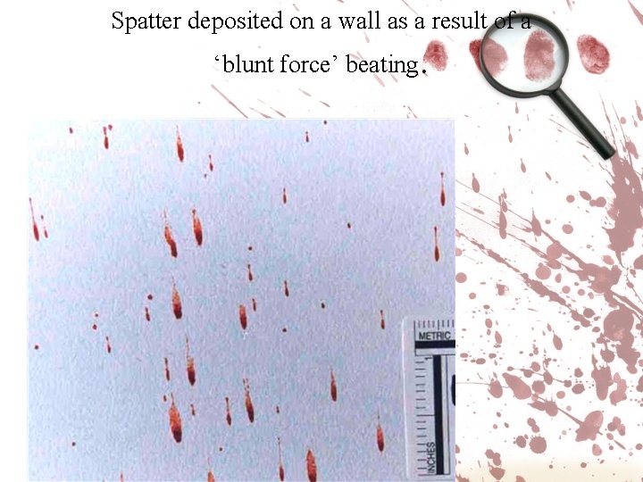 Spatter deposited on a wall as a result of a ‘blunt force’ beating. 