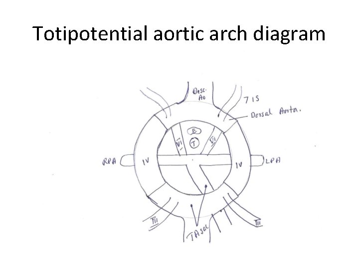 Totipotential aortic arch diagram 