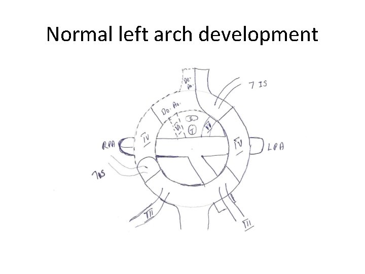 Normal left arch development 