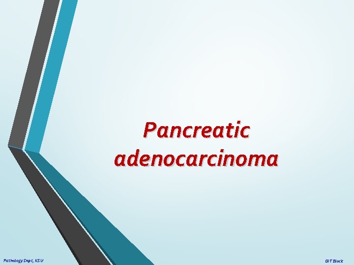 Pancreatic adenocarcinoma Pathology Dept, KSU GIT Block 