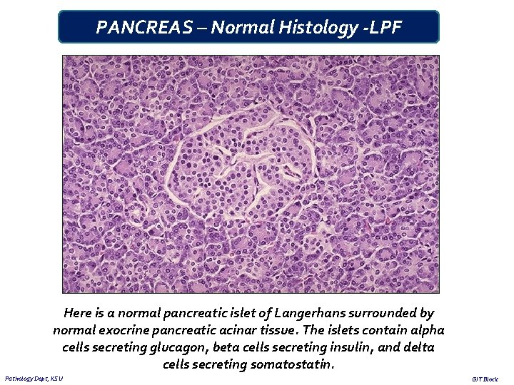 PANCREAS – Normal Histology -LPF Here is a normal pancreatic islet of Langerhans surrounded