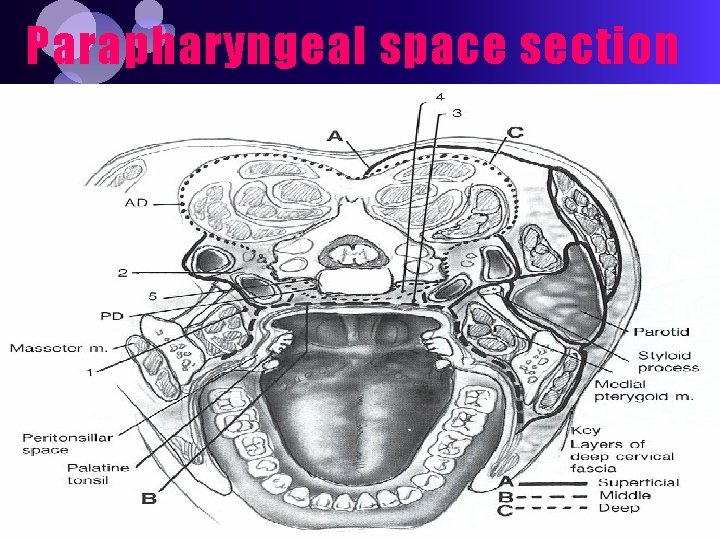 Parapharyngeal space section 