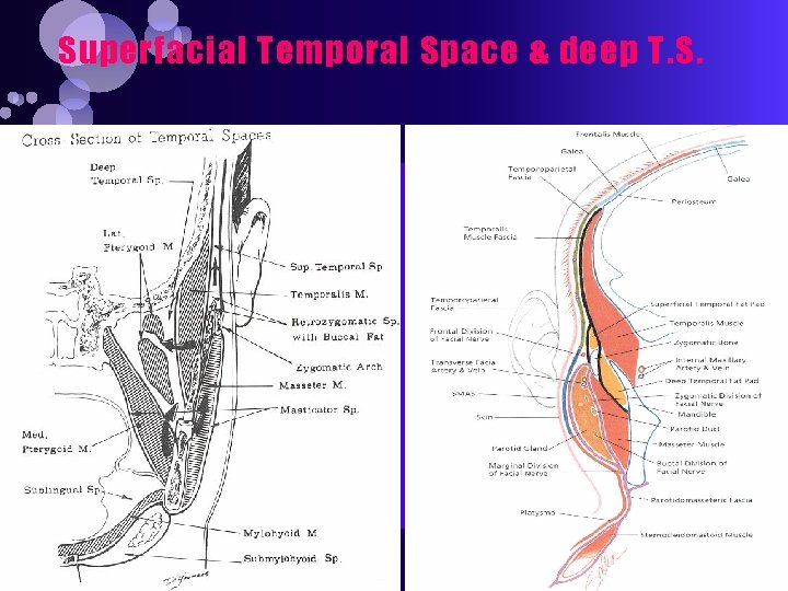 Superfacial Temporal Space & deep T. S. 
