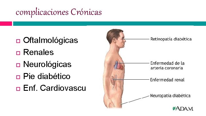 complicaciones Crónicas Oftalmológicas Renales Neurológicas Pie diabético Enf. Cardiovascular 