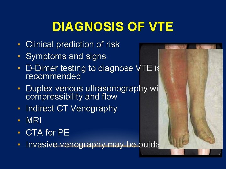 DIAGNOSIS OF VTE • Clinical prediction of risk • Symptoms and signs • D-Dimer