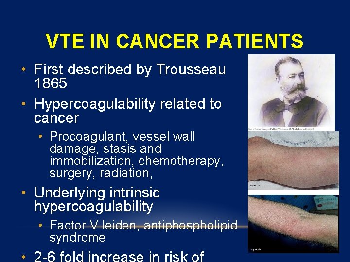 VTE IN CANCER PATIENTS • First described by Trousseau 1865 • Hypercoagulability related to