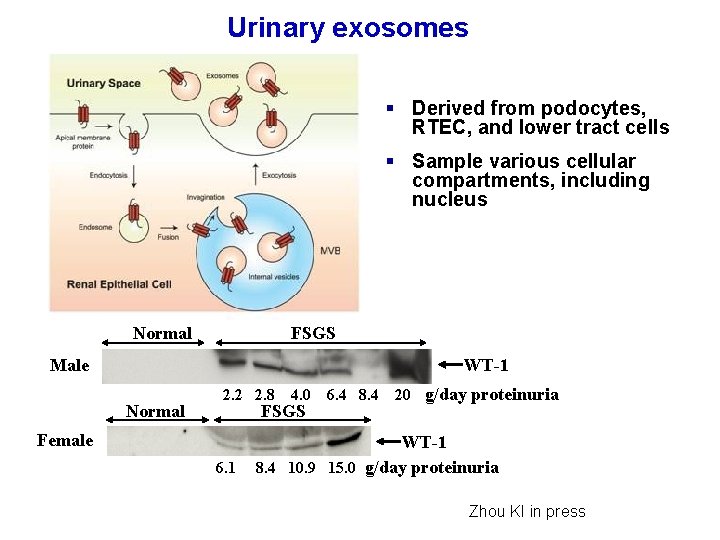 Urinary exosomes § Derived from podocytes, RTEC, and lower tract cells § Sample various