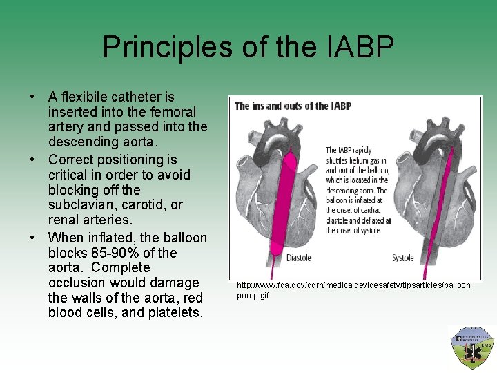 Principles of the IABP • A flexibile catheter is inserted into the femoral artery