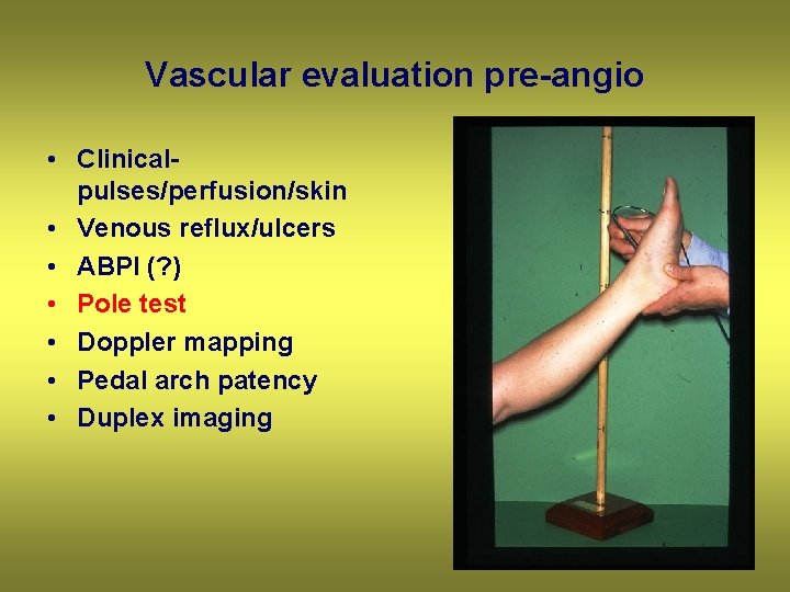 Vascular evaluation pre-angio • Clinicalpulses/perfusion/skin • Venous reflux/ulcers • ABPI (? ) • Pole