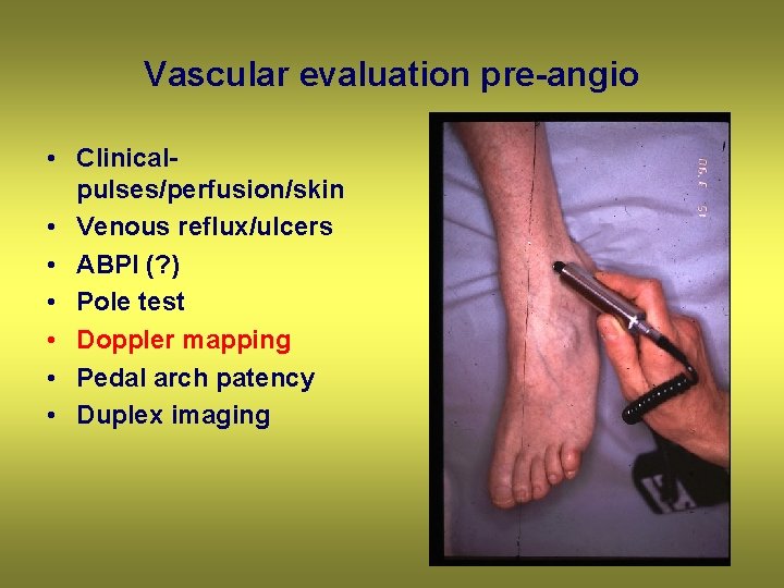 Vascular evaluation pre-angio • Clinicalpulses/perfusion/skin • Venous reflux/ulcers • ABPI (? ) • Pole