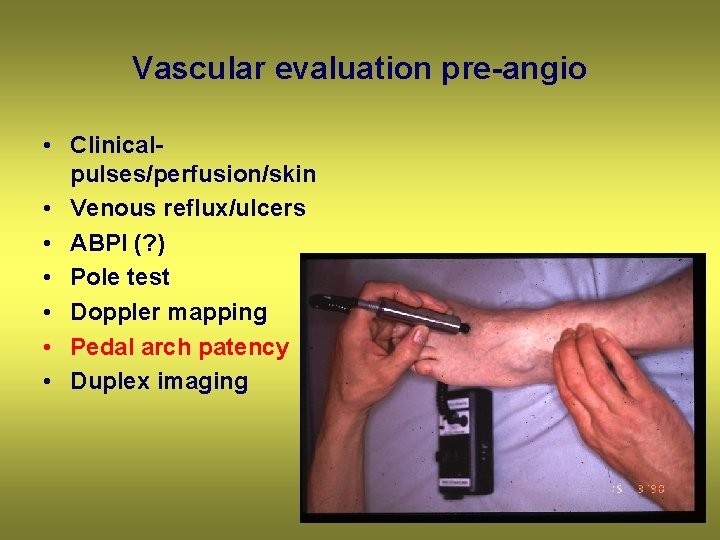 Vascular evaluation pre-angio • Clinicalpulses/perfusion/skin • Venous reflux/ulcers • ABPI (? ) • Pole