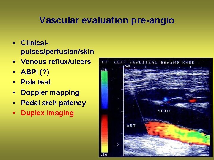 Vascular evaluation pre-angio • Clinicalpulses/perfusion/skin • Venous reflux/ulcers • ABPI (? ) • Pole