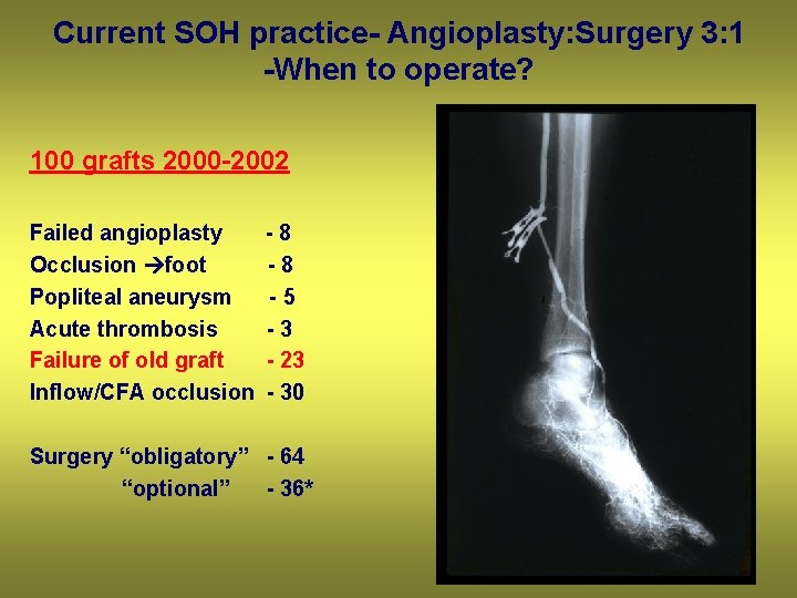 Current SOH practice- Angioplasty: Surgery 3: 1 -When to operate? 100 grafts 2000 -2002