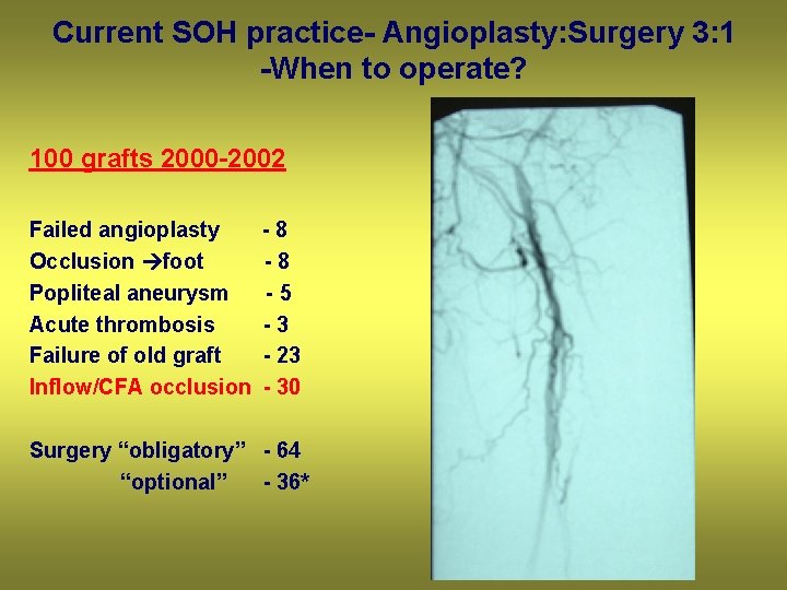 Current SOH practice- Angioplasty: Surgery 3: 1 -When to operate? 100 grafts 2000 -2002