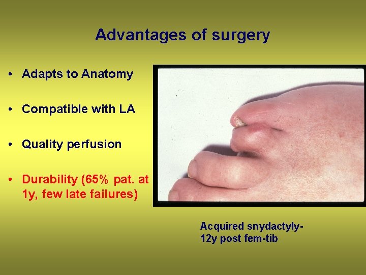 Advantages of surgery • Adapts to Anatomy • Compatible with LA • Quality perfusion