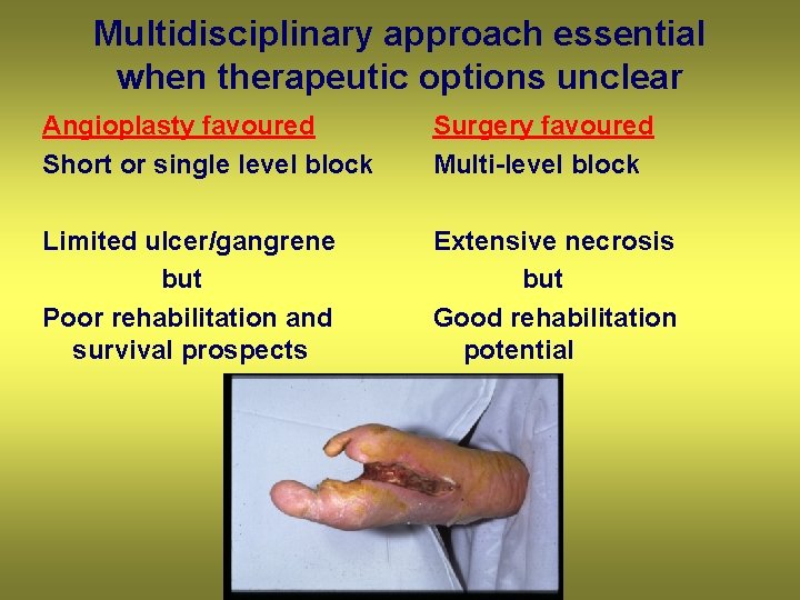 Multidisciplinary approach essential when therapeutic options unclear Angioplasty favoured Short or single level block