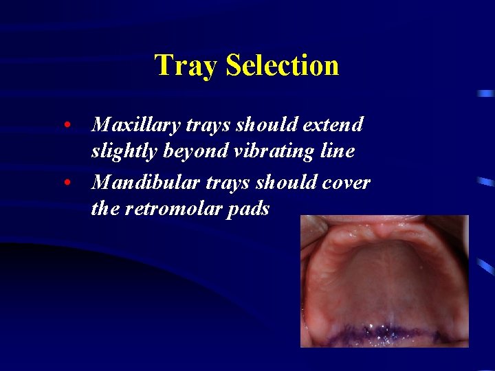 Tray Selection • Maxillary trays should extend slightly beyond vibrating line • Mandibular trays