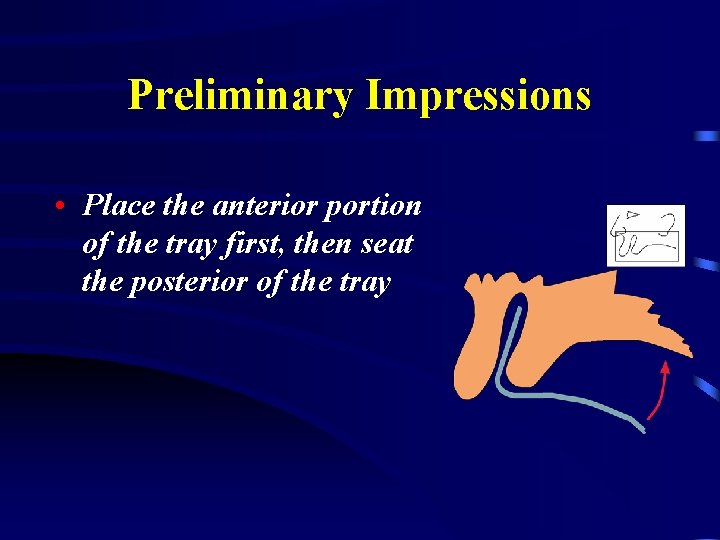 Preliminary Impressions • Place the anterior portion of the tray first, then seat the