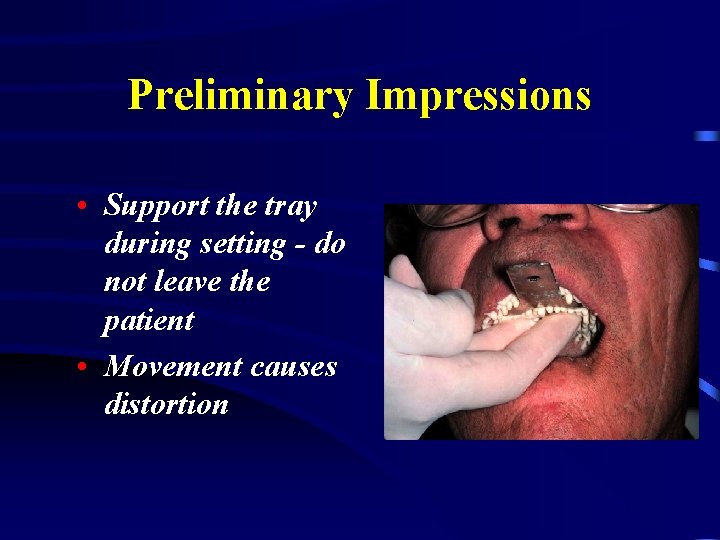 Preliminary Impressions • Support the tray during setting - do not leave the patient