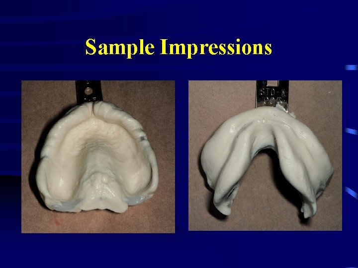 Sample Impressions 