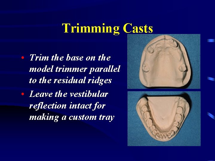 Trimming Casts • Trim the base on the model trimmer parallel to the residual