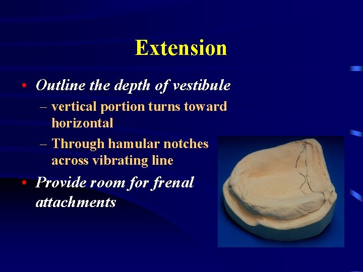Extension • Outline the depth of vestibule – vertical portion turns toward horizontal –