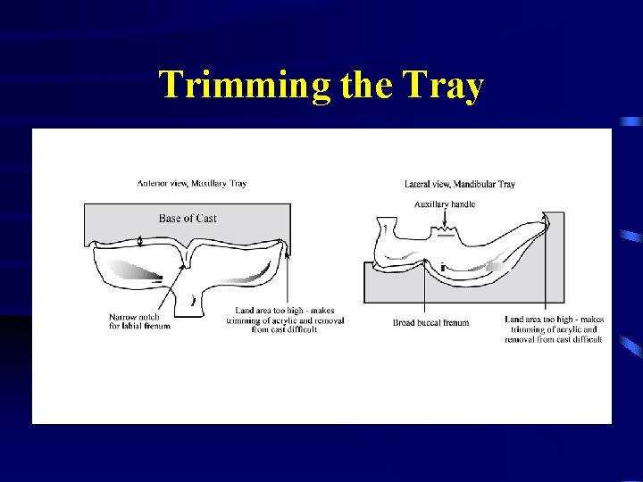 Trimming the Tray 