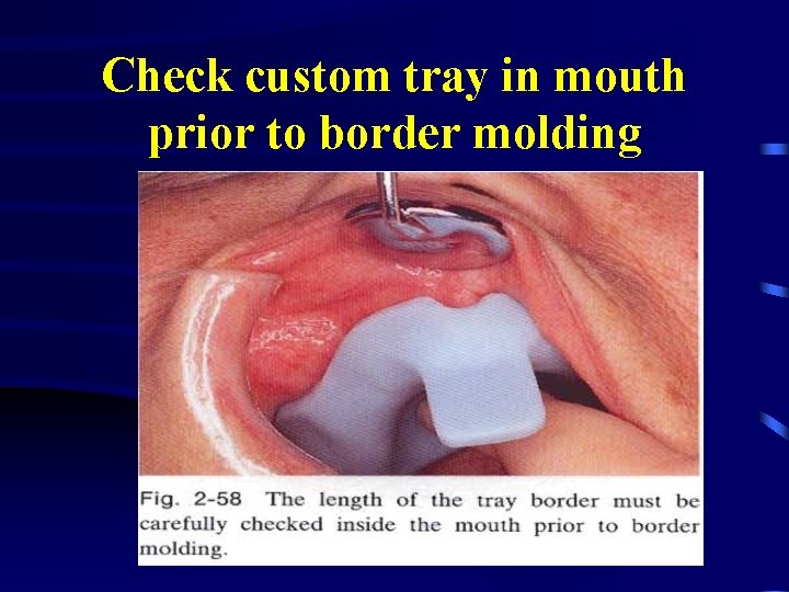 Check custom tray in mouth prior to border molding 