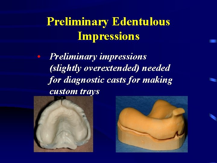 Preliminary Edentulous Impressions • Preliminary impressions (slightly overextended) needed for diagnostic casts for making