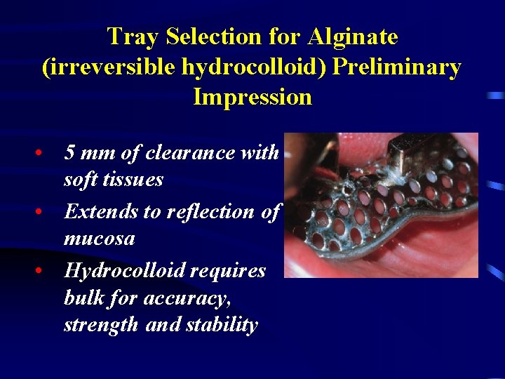 Tray Selection for Alginate (irreversible hydrocolloid) Preliminary Impression • 5 mm of clearance with