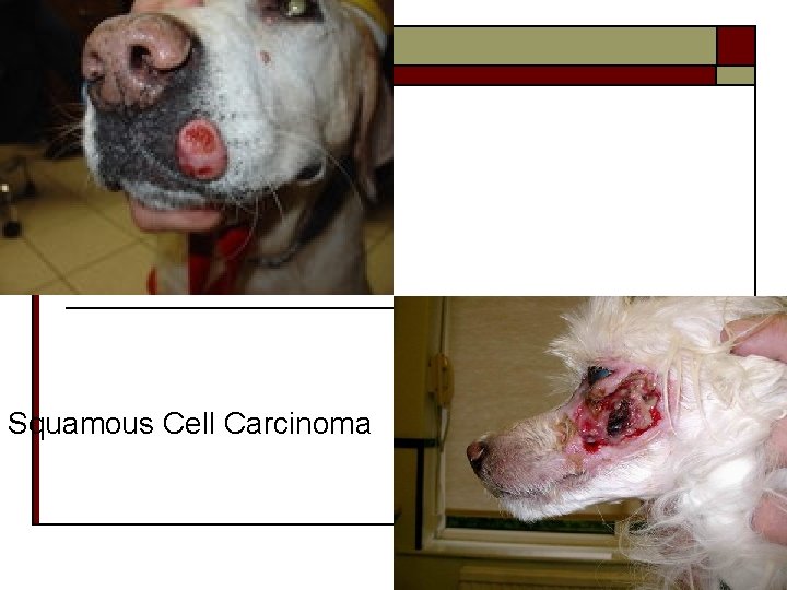 Squamous Cell Carcinoma 