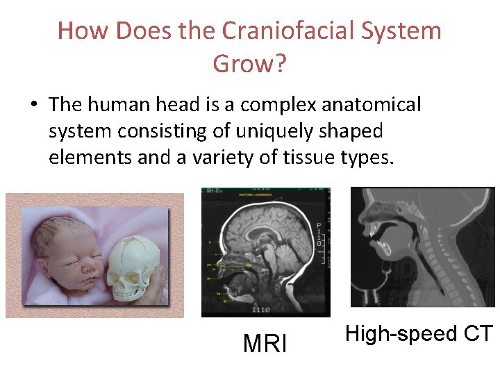 How Does the Craniofacial System Grow? • The human head is a complex anatomical