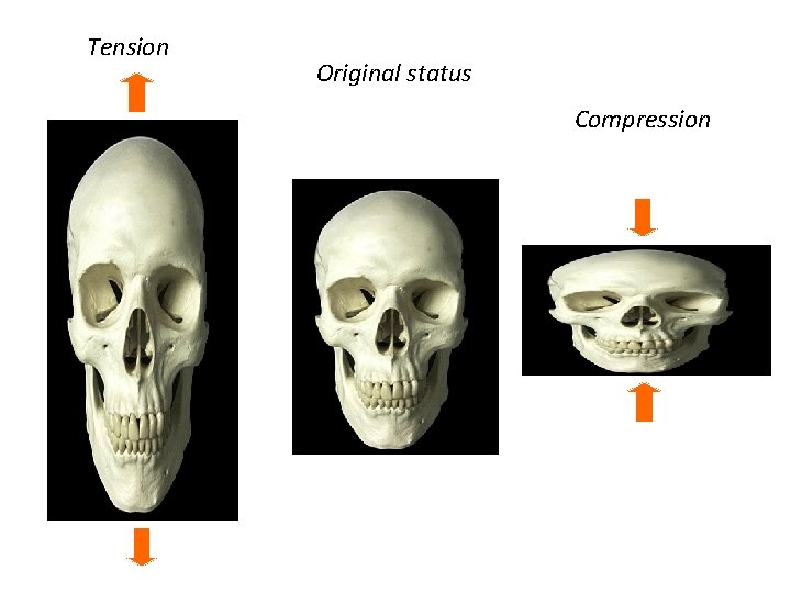 Tension Original status Compression 