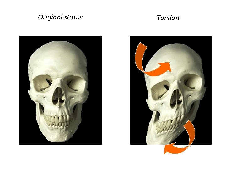 Original status Torsion 