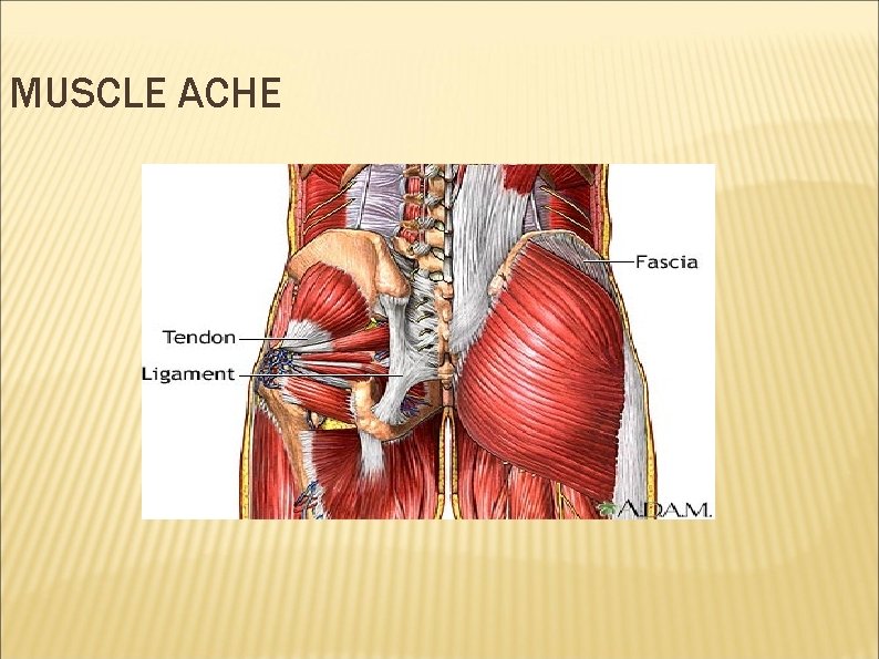 MUSCLE ACHE 