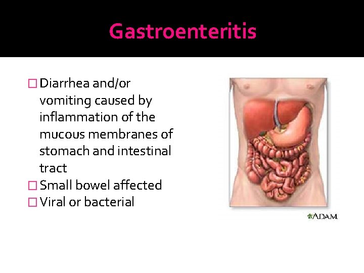 Gastroenteritis � Diarrhea and/or vomiting caused by inflammation of the mucous membranes of stomach