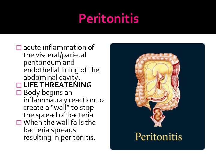 Peritonitis � acute inflammation of the visceral/parietal peritoneum and endothelial lining of the abdominal