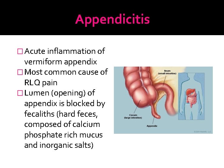 Appendicitis � Acute inflammation of vermiform appendix � Most common cause of RLQ pain