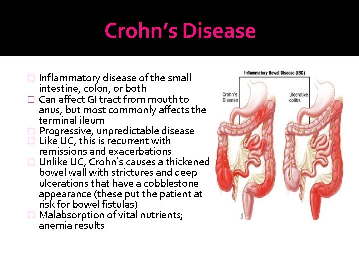 Crohn’s Disease � � � Inflammatory disease of the small intestine, colon, or both